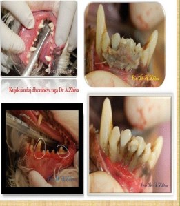 kujdesi ndaj dhembeve