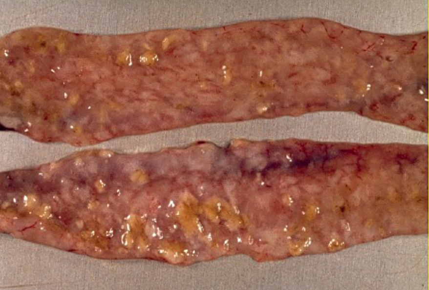 Porcion i zorreve te lepujve te prekur me koksidioza